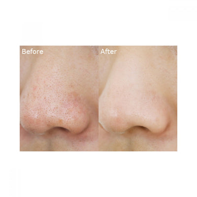 MA:NYO Pure Cleansing Oil – Award-Winning Korean Makeup Remover & Cleanser